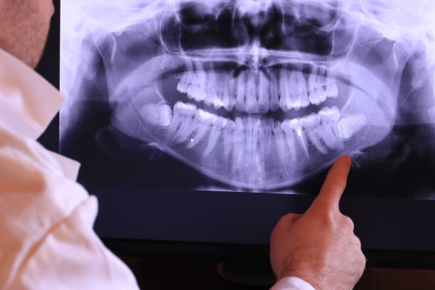 Best Pediatric Emergency Dentist in Sandy Hook, CT