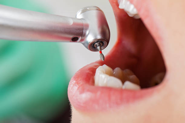 Best Emergency Dentist for Knocked-Out Tooth in Sandy Hook, CT